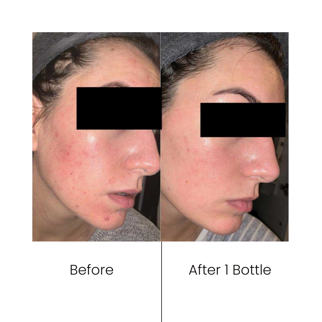 RETINOL SERUM