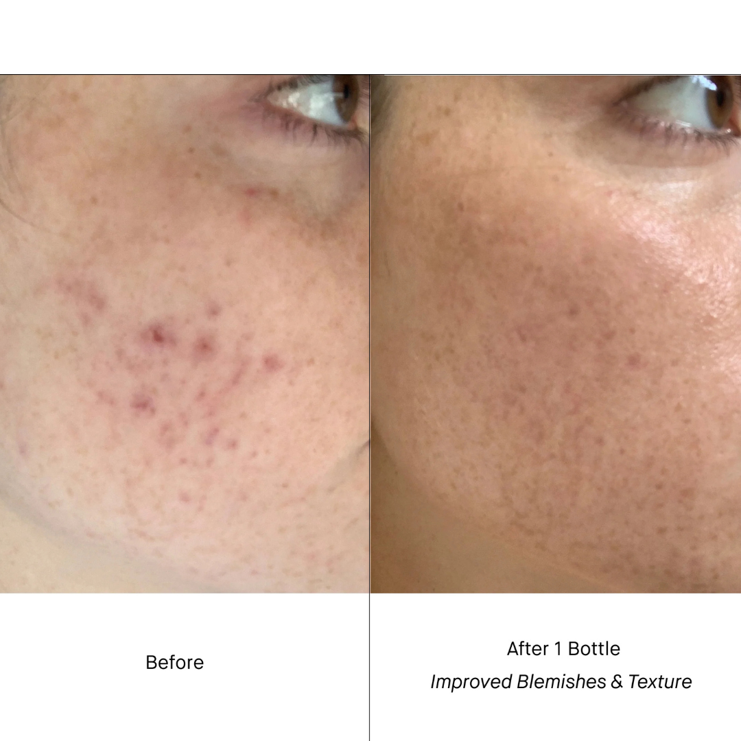 RETINOL SERUM