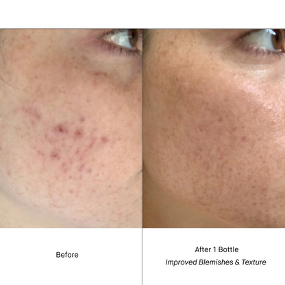 RETINOL SERUM