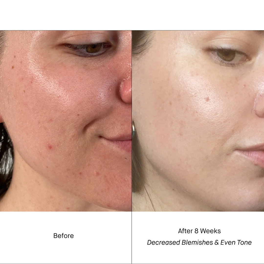 RETINOL SERUM