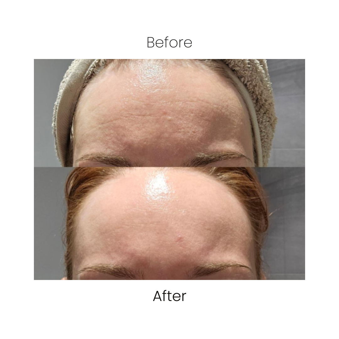RETINOL SERUM