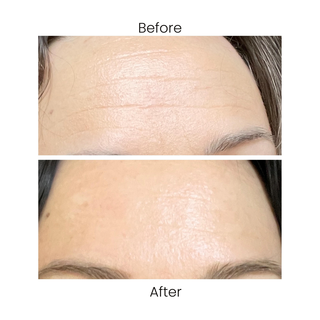 RETINOL SERUM